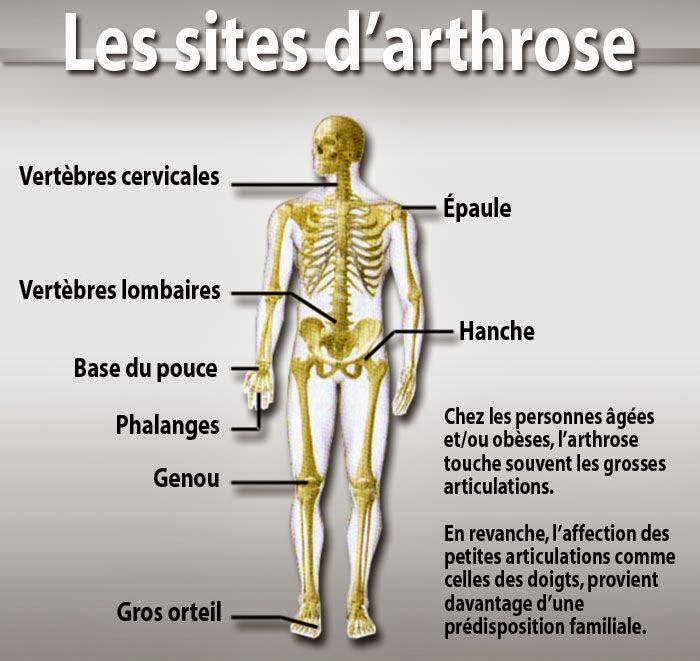 Dr. Julien Lévesque, chiropraticien | 179 Rue Fraser, Rivière-du-Loup, QC G5R 1E2, Canada | Phone: (418) 867-2773