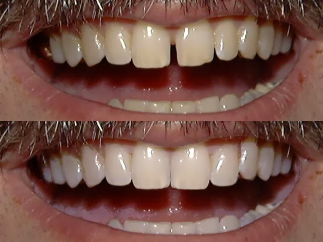 Parkside Dental | 205 Norfolk St N, Simcoe, ON N3Y 3N9, Canada | Phone: (519) 428-2506