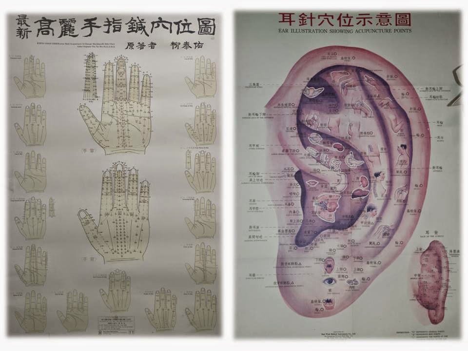 Acupuncture Chinoise HY TRAN de Sherbrooke 中國針灸診所 | 99 Rue Gordon, Sherbrooke, QC J1H 4Y4, Canada | Phone: (819) 822-1153