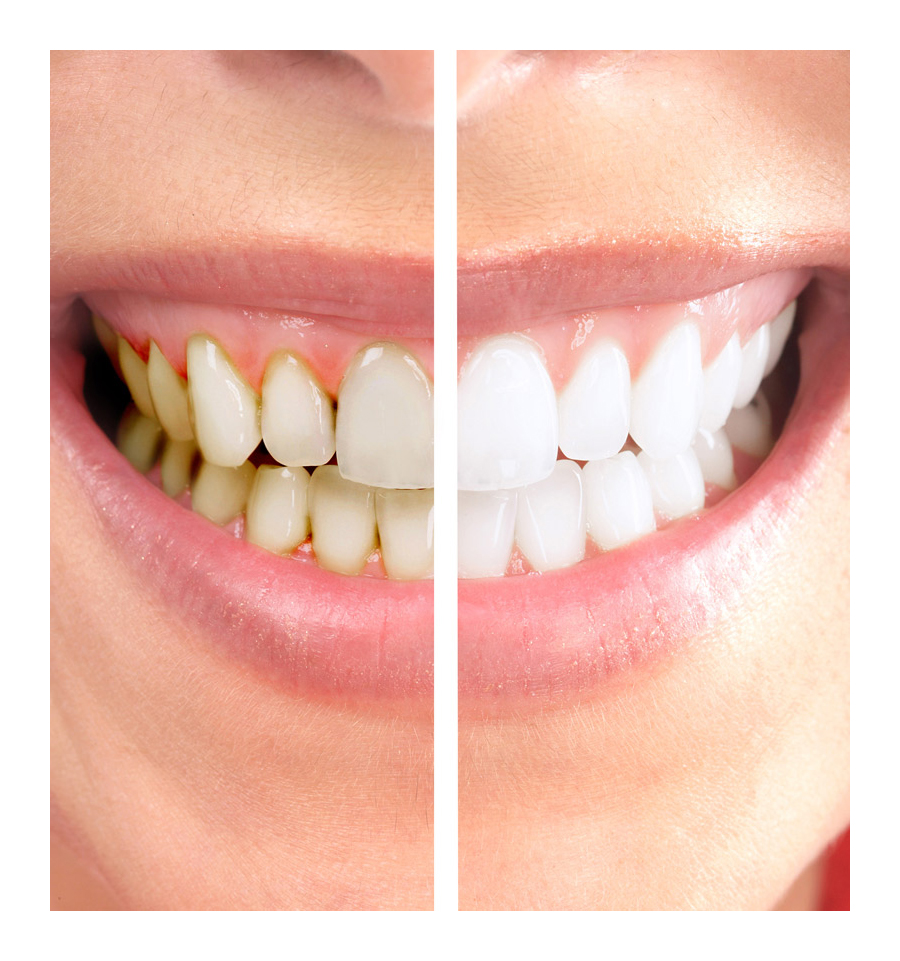 Dr. Ricky Leung | Dental Office | 2900 Steeles Ave E #201, Thornhill, ON L3T 4X1, Canada | Phone: (905) 881-3434