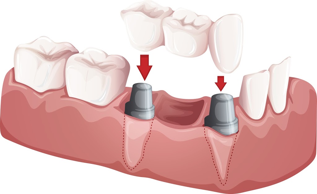 Dr. Ricky Leung | Dental Office | 2900 Steeles Ave E #201, Thornhill, ON L3T 4X1, Canada | Phone: (905) 881-3434