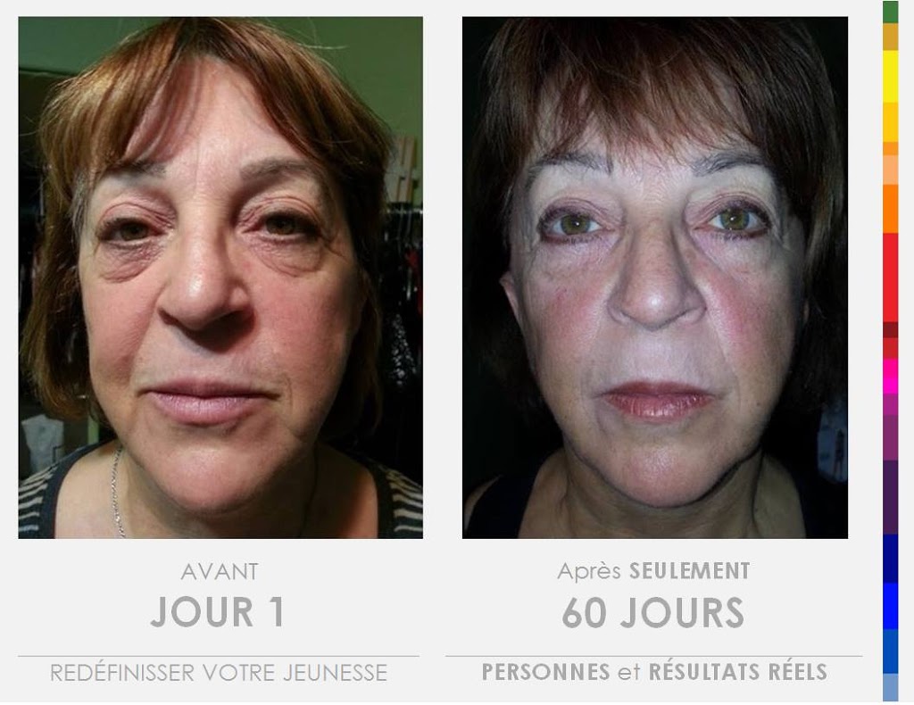 evolution beaute | 1172 Rue Saint Louis, Saint-Jean-Chrysostome, QC G6Z 2L2, Canada | Phone: (418) 956-9488