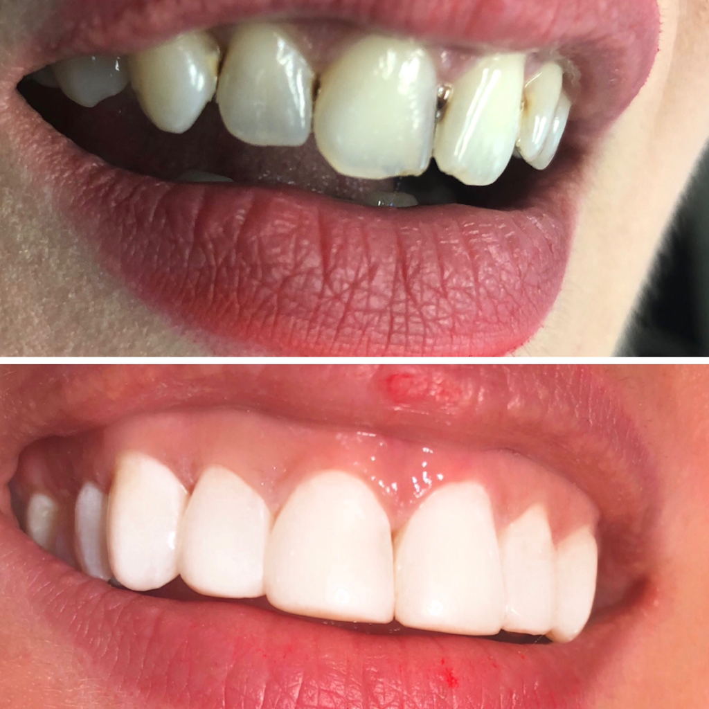 Swansea Dentistry | 2489 Bloor St W #103, Toronto, ON M6S 1R6, Canada | Phone: (416) 766-8005