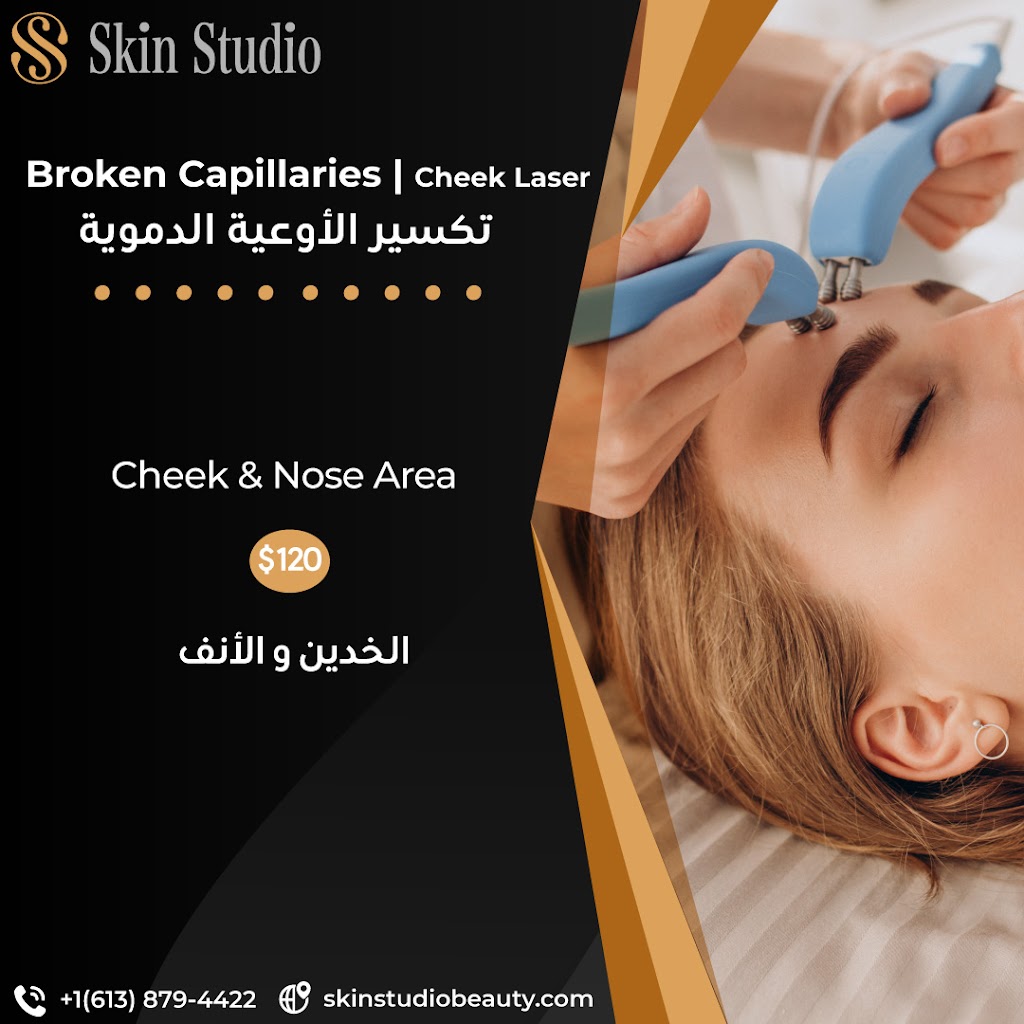 Skin Studio Beauty - Shrein | 265 Gracewood Crescent, Gloucester, ON K1T 0J1, Canada | Phone: (613) 879-4422