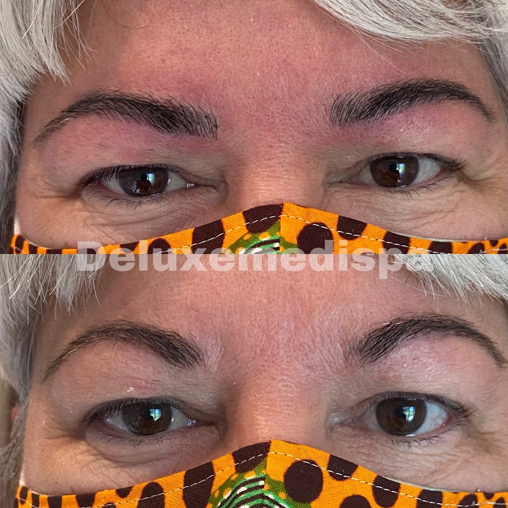 Deluxe Medispa - New Tecumseth Laser Skin Clinic | 10 Catherine St, Loretto, ON L0G 1L0, Canada | Phone: (416) 577-7840