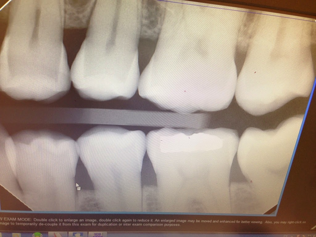 Sharshar Dental | 9228 144 Ave NW, Edmonton, AB T5E 6A3, Canada | Phone: (780) 970-7777