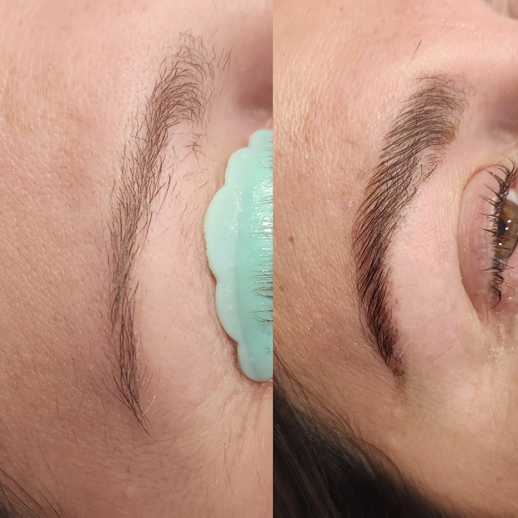 KNL Esthetics | 2414 16 Ave NW #350, Calgary, AB T2M 0M5, Canada | Phone: (403) 519-0413