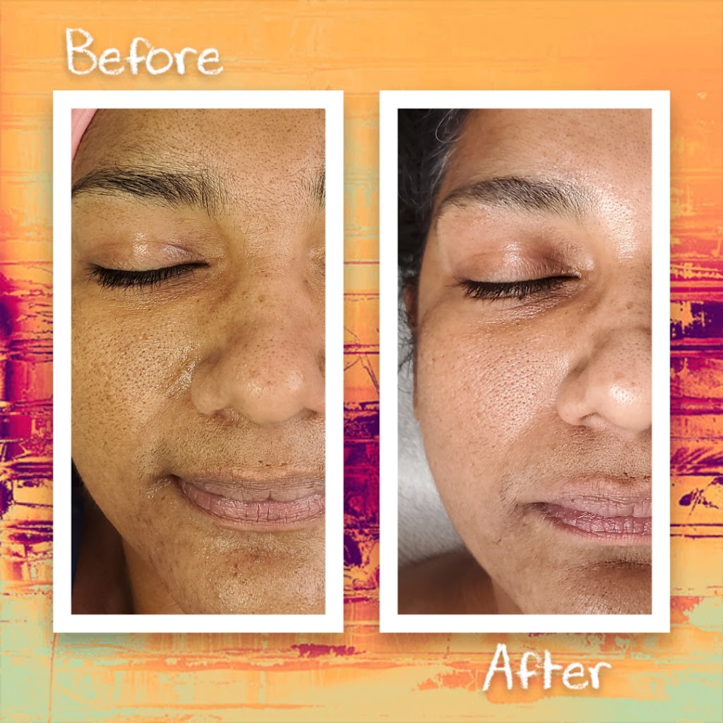 Vitality Esthetics & Medspa | 100 Kent St #140, Red Deer, AB T4P 4E5, Canada | Phone: (587) 815-5099