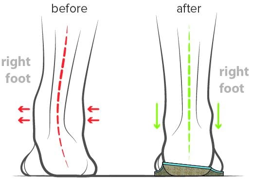 SpaceWalk3d Feet Comfort Centre | 113 Richmond Blvd Unit 10, Napanee, ON K7R 3Z8, Canada | Phone: (613) 318-9596