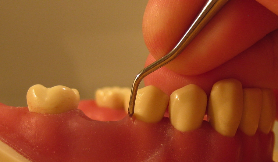 Dental Clinic Dr.Mansouri | 260 Boulevard Saint-Raymond #202, Gatineau, QC J9A 3G7, Canada | Phone: (819) 595-3444
