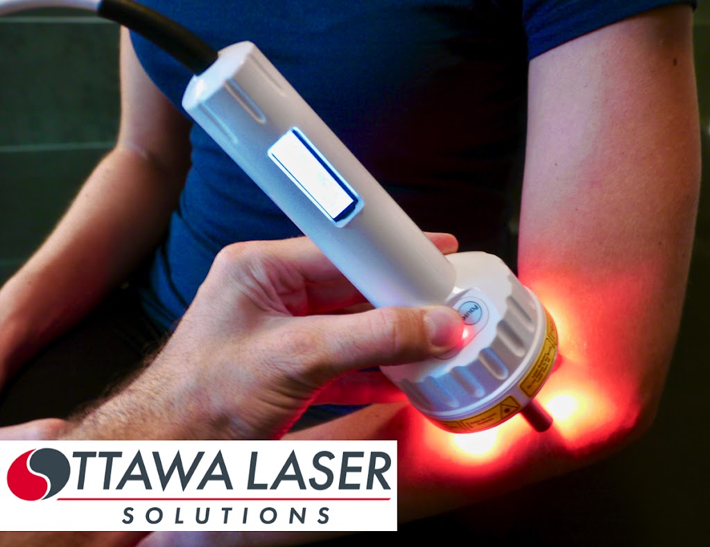 Ottawa Laser Solutions - WESTBORO | 1399 Wellington St. W, Ottawa, ON K1Y 2X1, Canada | Phone: (613) 722-3769