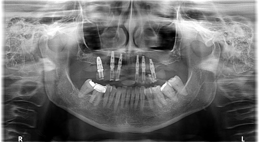 North Hill Dental Center | 9993 Yonge St, Richmond Hill, ON L4C 1T9, Canada | Phone: (905) 508-2244