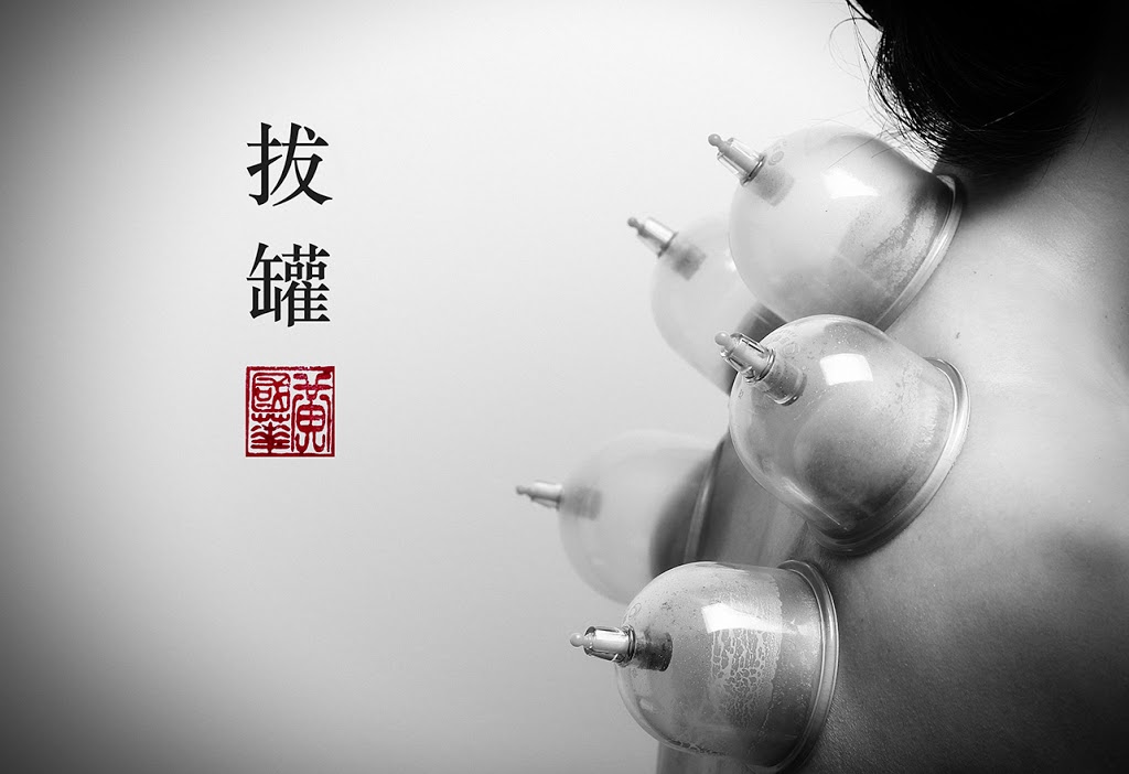 Inner Qi Acupuncture | 525 Snider Mountain Rd, Snider Mountain, NB E5P 4B4, Canada | Phone: (506) 434-0871