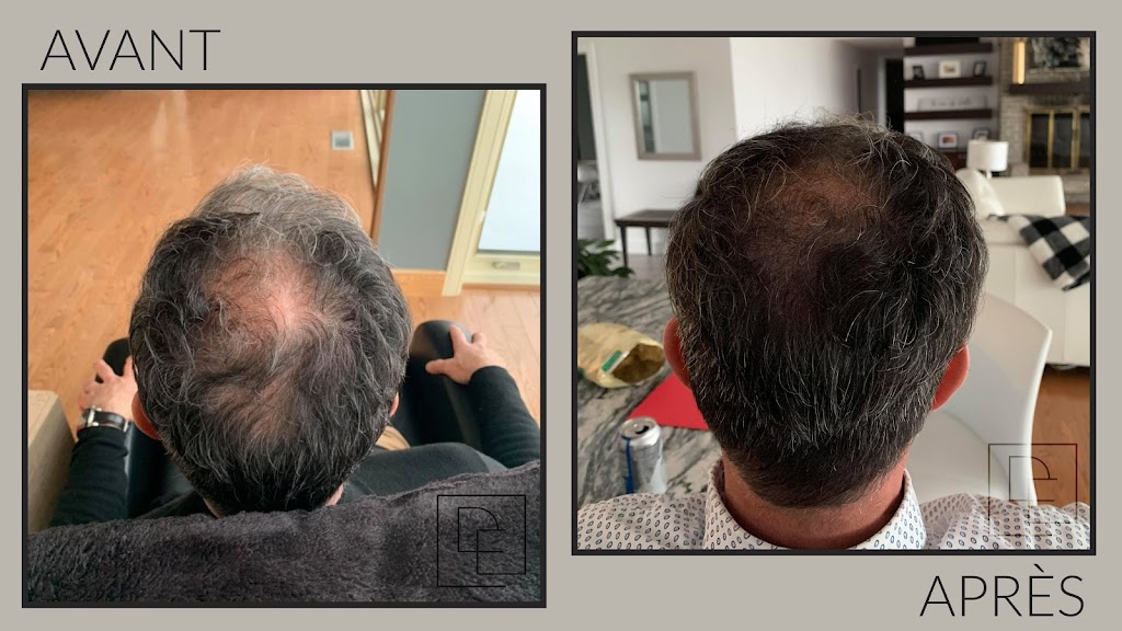 Dermal Essence | 44 Terr. Bellerive, Lavaltrie, QC J5T 1A6, Canada | Phone: (819) 470-8094