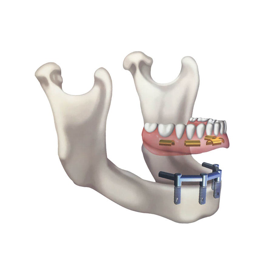 Clinique de Denturologie ProtaDent | 7083 Rue Jarry E #219, Montreal, QC H1J 1G3, Canada | Phone: (514) 312-2909
