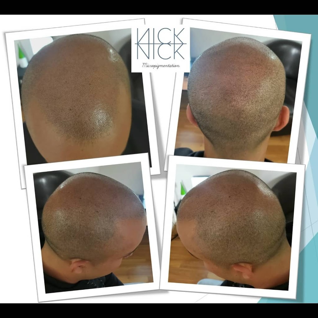 Nick Micropigmentation | 6150 Valley Way Unit A118, Niagara Falls, ON L2E 1X9, Canada | Phone: (289) 321-2183