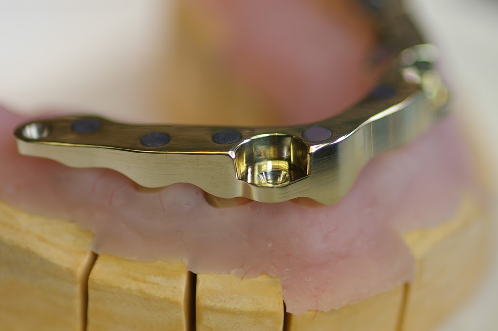 Implant Restorations Inc | 661 Sandford Rd, Uxbridge, ON L9P 1R2, Canada | Phone: (866) 802-3623