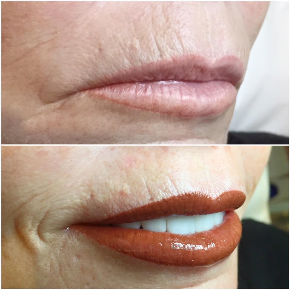 The FACE Studio | 10312 164a St, Surrey, BC V4N 5M4, Canada | Phone: (604) 496-2769