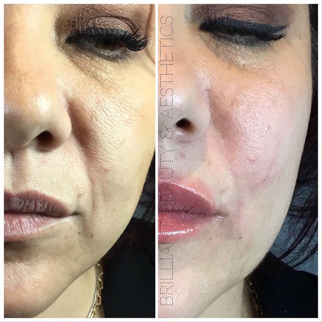 Brilliant Beauty & Aesthetics | 20 New Delhi Drive Unit 100 Upper Level, Markham, ON L3S 0B5, Canada | Phone: (905) 554-8333