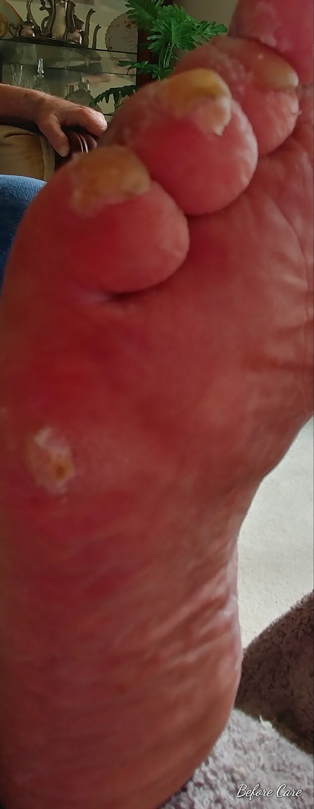 Healthy Feet Mobile Foot Care Services | Gough Ave, London, ON N5X 4P8, Canada | Phone: (519) 933-9155