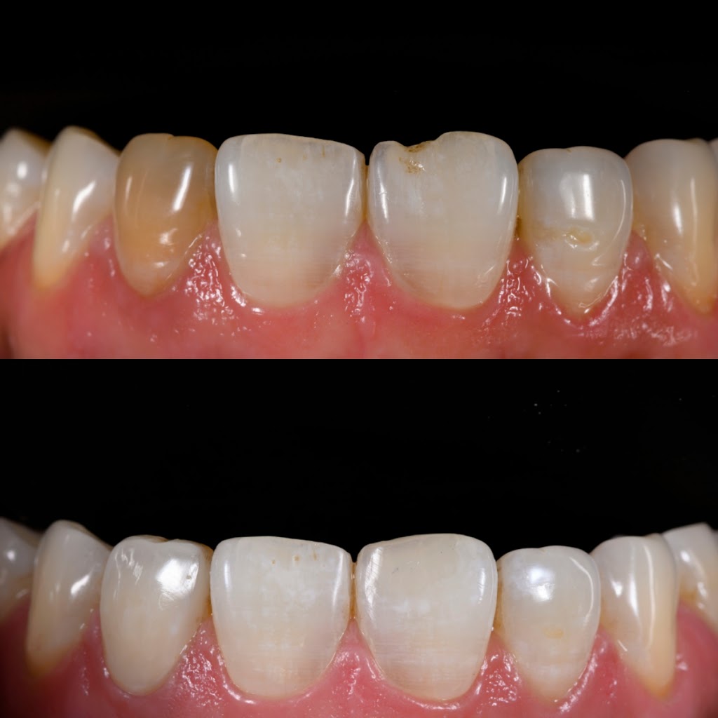 R Dentists | 6733 Mississauga Rd Suite102, Mississauga, ON L5N 6J5, Canada | Phone: (905) 567-6757