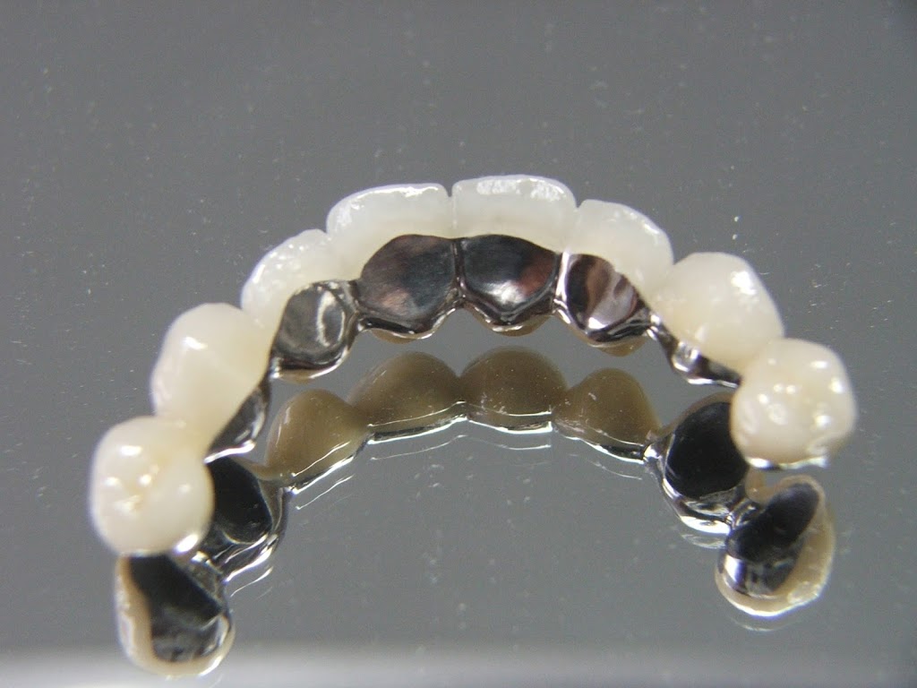 Cad Crowns Ca Inc | 210-1580 Merivale Rd, Nepean, ON K2G 4B5, Canada | Phone: (613) 723-7300