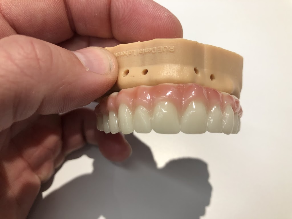Kasper Denture clinic ltd | 1710 Ellis St Suite 25, Kelowna, BC V1W 3S9, Canada | Phone: (250) 717-3730