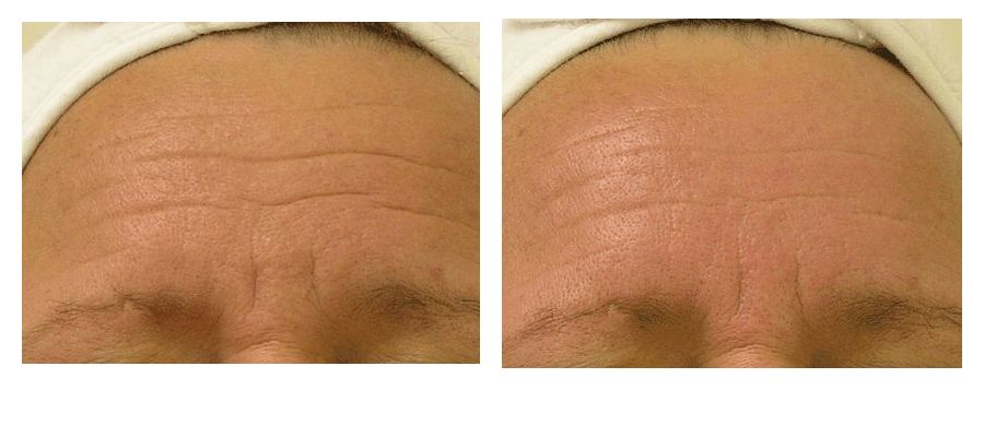 Fresca Beauty | 1949 Weston Rd, Toronto, ON M9N 1W8, Canada | Phone: (647) 696-6184