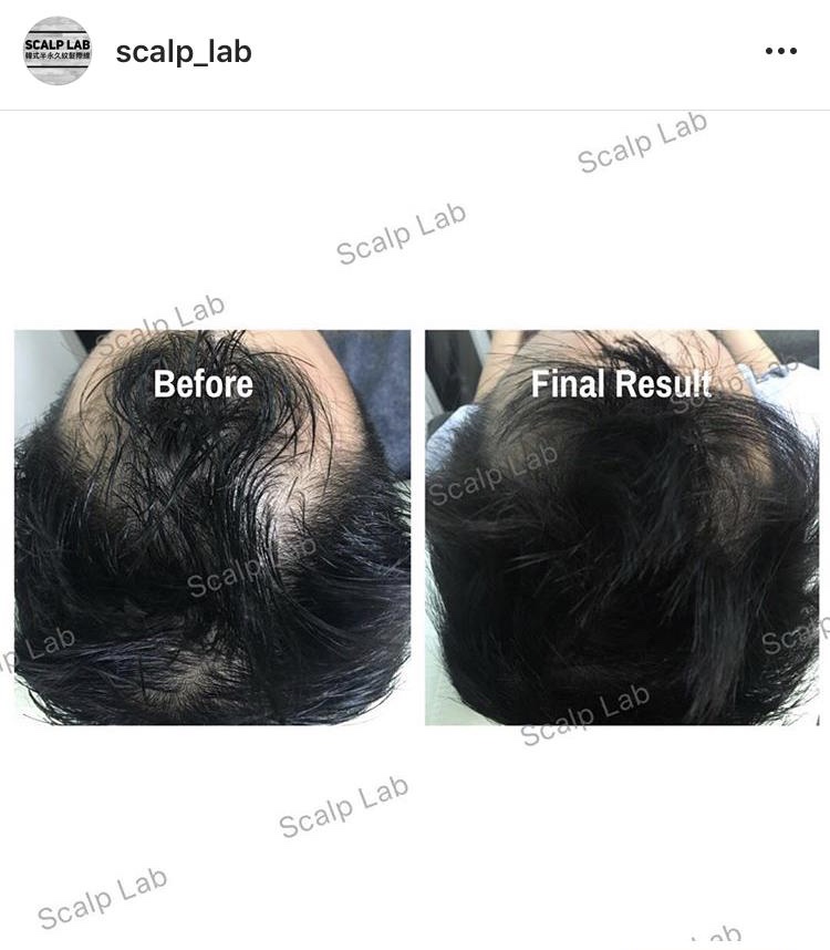 Scalp Lab | 135 Village Green Square, Scarborough, ON M1S 0G4, Canada | Phone: (416) 823-9300