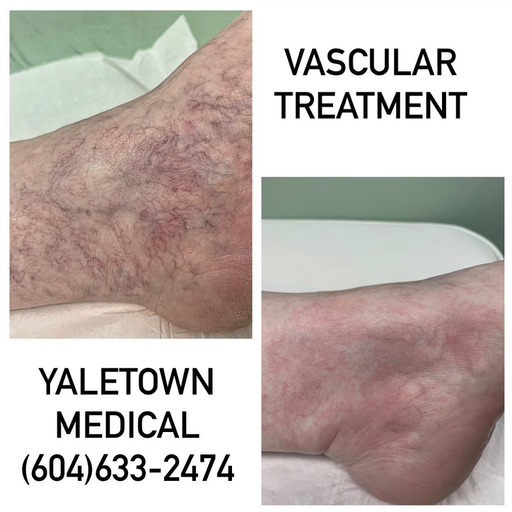 Medic laser and Skin care | 1296 Pacific Blvd, Vancouver, BC V6Z 2V1, Canada | Phone: (604) 633-2474