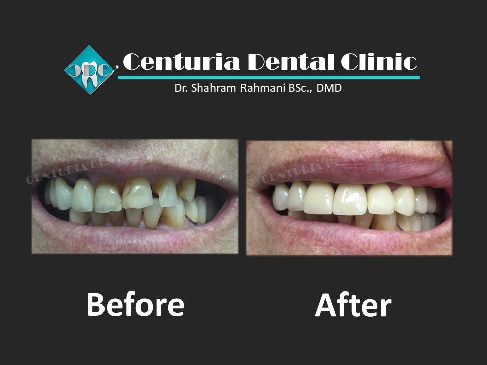 Centuria Dental Clinic | 5-1131 Lawson Ave, Kelowna, BC V1Y 6T8, Canada | Phone: (236) 420-0210