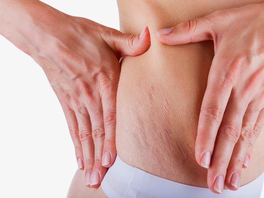 Toronto Medical Aesthetics, | 411 Manhattan Dr #7, Unionville, ON L3P 7P4, Canada | Phone: (905) 947-1221