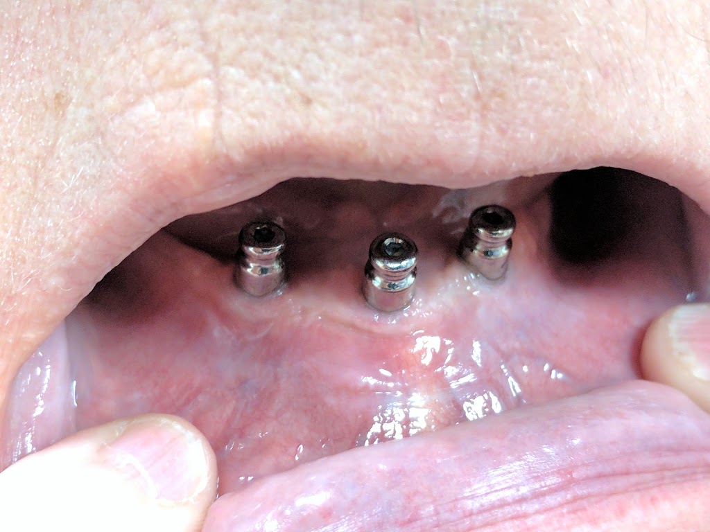 Perth Denture Clinic | 33 Wilson St W, Perth, ON K7H 2N1, Canada | Phone: (613) 264-5452