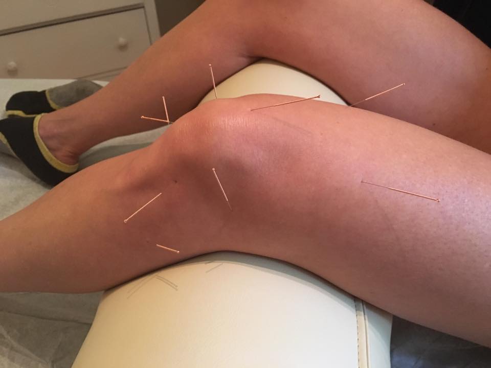 Acupuncture Geneviève Goudreault - Chicoutimi | 484 Bd du Royaume O suite 380.12, Chicoutimi, QC G7H 0S7, Canada | Phone: (418) 272-2722