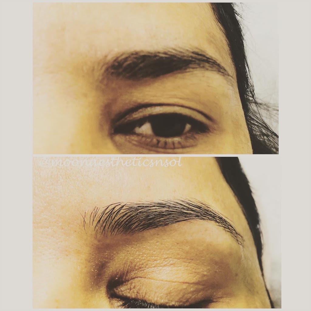 Moon Aesthetics n Solutions | 159 Shephard Ave, Alliston, ON L9R 0J8, Canada | Phone: (705) 718-1836