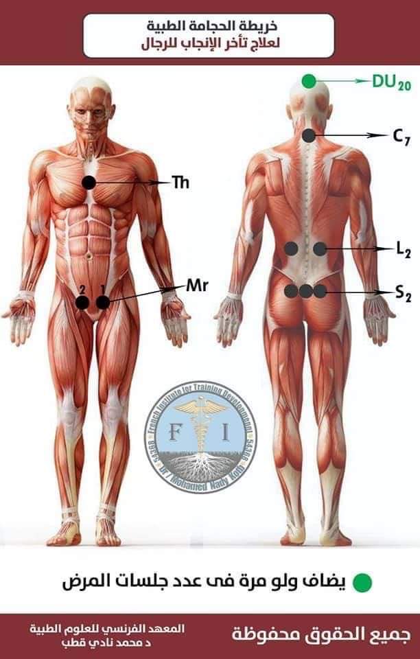 Hijama montreal clinic | 5805 Rue Lauzon, Montréal-Nord, QC H1G 2G9, Canada | Phone: (438) 221-5070