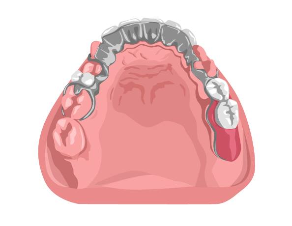 Centre de Denturologie Ranger et Associés. | 2424 Boul. Lapinière, Brossard, QC J4Z 2K9, Canada | Phone: (450) 465-9111