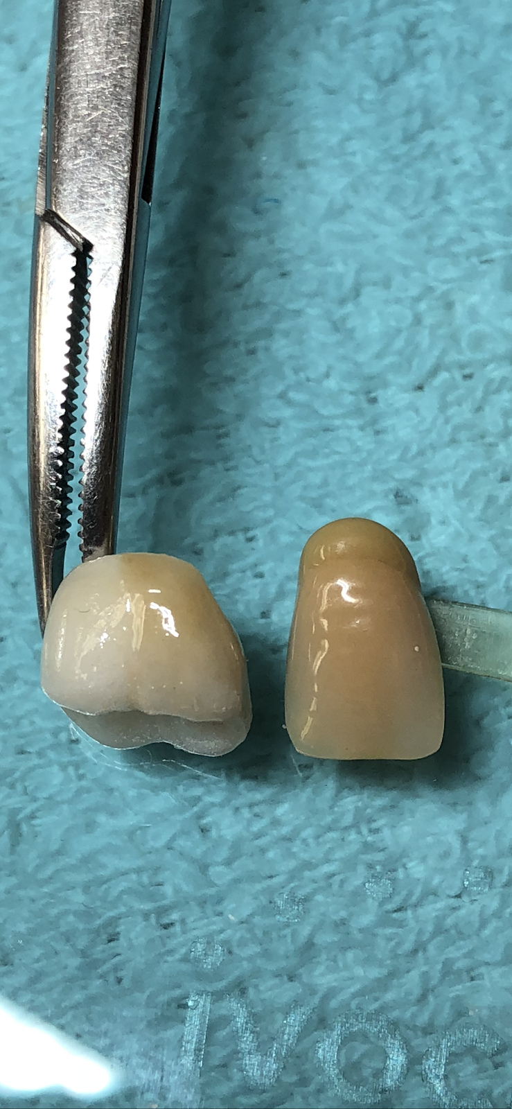 Labworks Dental Services | 10160 Ainsworth Crescent, Richmond, BC V7A 3V4, Canada | Phone: (604) 916-1875