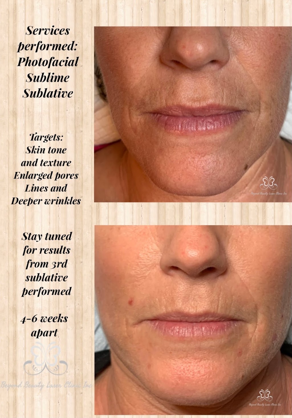 Beyond Beauty Laser Clinic Inc | 3939 50a Ave Unit 104, Red Deer, AB T4N 4E6, Canada | Phone: (403) 304-0394
