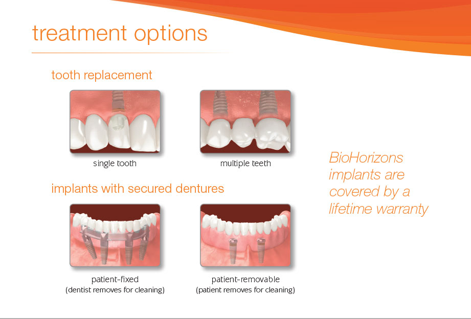Centre Dentaire Lakeshore | 22 Rue Canvin, Kirkland, QC H9H 4S4, Canada | Phone: (514) 694-5716
