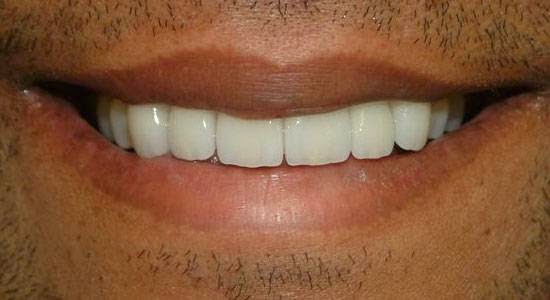 Second Nature Dental Innovations | 620 Alden Rd, Markham, ON L3R 9R7, Canada | Phone: (905) 752-0144