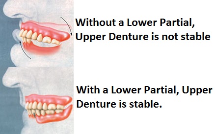 Oakridge Denture Centre Ltd | 2580 Southland Dr SW, Calgary, AB T2V 4J8, Canada | Phone: (403) 251-1522
