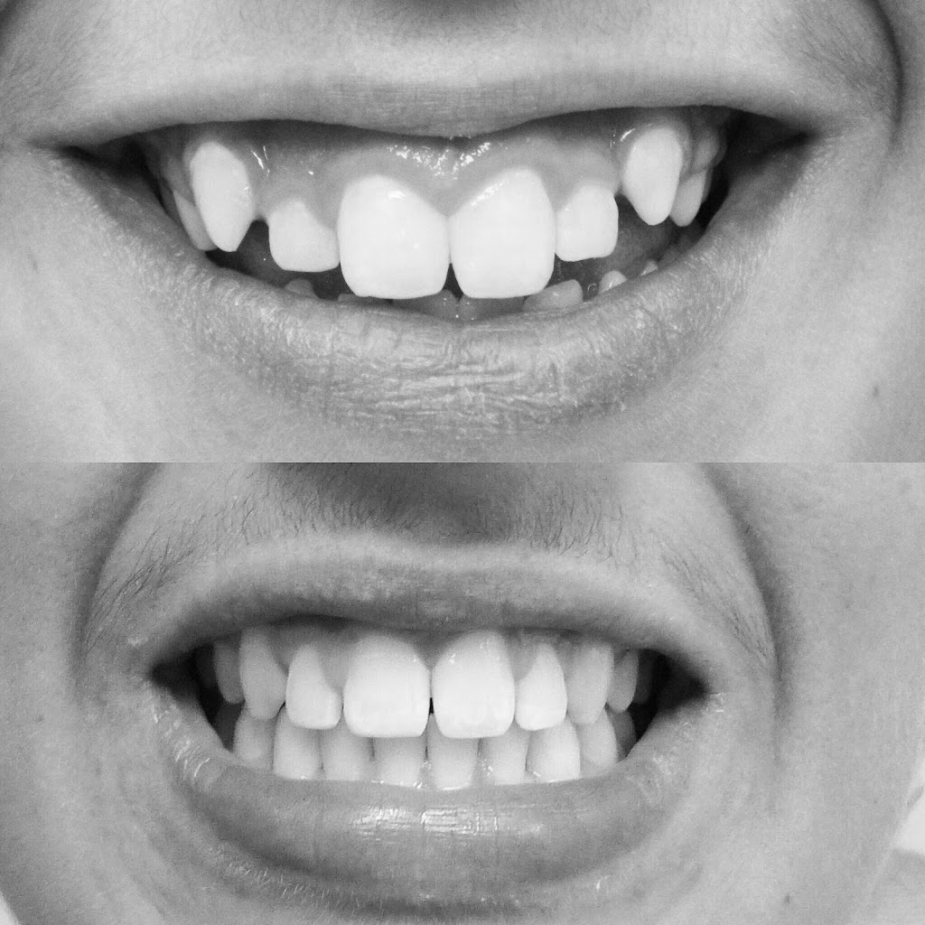 Streetsville Dental | 117 Queen St S #2, Mississauga, ON L5M 6B5, Canada | Phone: (905) 567-8899