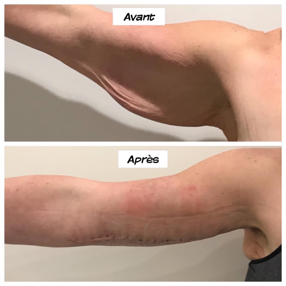 Clinique Medispa | 201 Rue Champlain Local 202, Bromont, QC J2L 3B2, Canada | Phone: (450) 726-9050