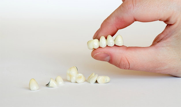 Smiles Dentistry | 1648 Bloor St W #1, Toronto, ON M6P 1A7, Canada | Phone: (416) 588-8004