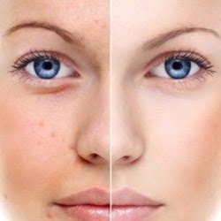 Fabeez Skin Care & Laser Inc. | 1424 Crozier Crescent, Milton, ON L9T 6N1, Canada | Phone: (647) 530-7750