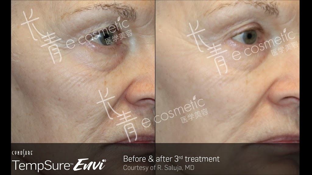 长青医学美容 - Evergreen Cosmetic | 500 Royal Oak Dr NW #216, Calgary, AB T3G 5J7, Canada | Phone: (403) 680-9960