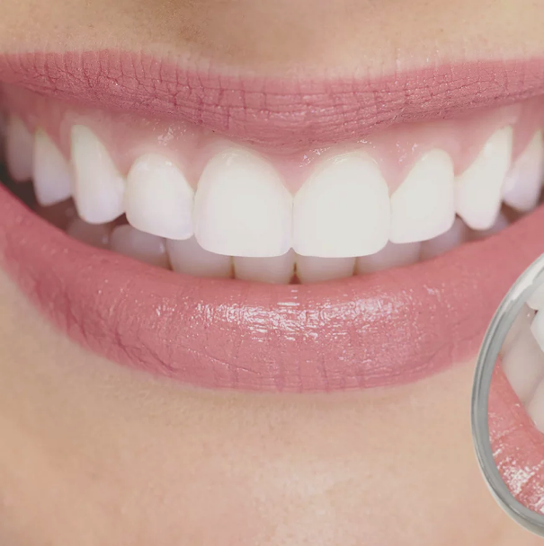 Clinique Dentaire Cité Mirabel | 11800 Rue de Chaumont bureau 400, Mirabel, QC J7J 0T8, Canada | Phone: (450) 508-1088