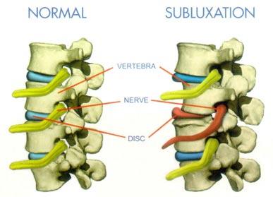 Life Chiropractic Centre | 8-2501 Guelph Line North, Burlington, ON L7M 2A3, Canada | Phone: (905) 335-5433