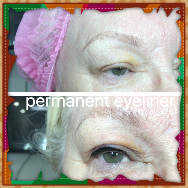 The Paris Laser Clinic | 10970 Bramalea Rd, Brampton, ON L6R 0C1, Canada | Phone: (647) 327-2747